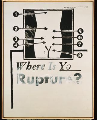 Where is Your Rupture?, 1961